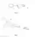 Fig. 03 - Dissection and ligation cartridge