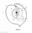 Fig. 04 - Resection devices and related methods of deployment