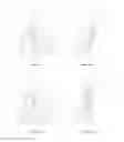Fig. 30 - Needle guides