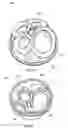 Fig. 25 - Sealing multiple surgical instruments