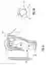 Fig. 31 - Sealing multiple surgical instruments