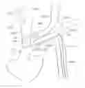 Fig. 01 - Arm access arch fulcrum support catheter