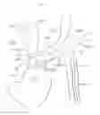 Fig. 02 - Arm access arch fulcrum support catheter