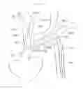 Fig. 04 - Arm access arch fulcrum support catheter