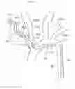 Fig. 05 - Arm access arch fulcrum support catheter