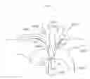 Fig. 06 - Arm access arch fulcrum support catheter