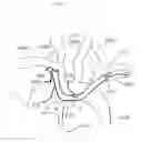 Fig. 07 - Arm access arch fulcrum support catheter