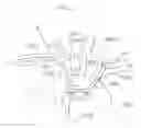 Fig. 10 - Arm access arch fulcrum support catheter