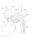 Fig. 02 - Method of use for an arm access arch fulcrum support catheter