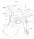 Fig. 04 - Method of use for an arm access arch fulcrum support catheter