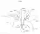 Fig. 06 - Method of use for an arm access arch fulcrum support catheter