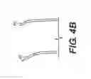 Fig. 06 - Percutaneous lead placement assembly