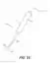 Fig. 19 - Percutaneous lead placement assembly