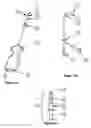 Fig. 02 - Methods and compositions for conduit occlusion