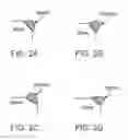 Fig. 05 - Method and apparatus for altering biomechanics of the shoulder