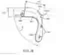 Fig. 09 - Method and apparatus for altering biomechanics of the shoulder