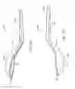 Fig. 15 - Method and apparatus for altering biomechanics of the shoulder