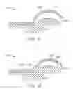 Fig. 20 - Method and apparatus for altering biomechanics of the shoulder