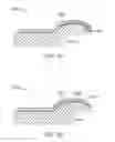 Fig. 24 - Method and apparatus for altering biomechanics of the shoulder