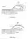 Fig. 27 - Method and apparatus for altering biomechanics of the shoulder