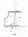 Fig. 04 - External fixator system