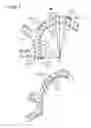 Fig. 05 - External fixation for the correction of bone deformity and trauma