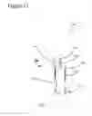 Fig. 14 - External fixation for the correction of bone deformity and trauma