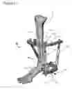 Fig. 16 - External fixation for the correction of bone deformity and trauma