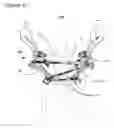 Fig. 18 - External fixation for the correction of bone deformity and trauma