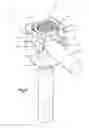 Fig. 16 - Bone fixation assembly