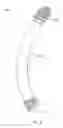 Fig. 04 - Shape adaptable intramedullary fixation device