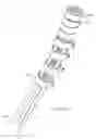 Fig. 10 - Shape adaptable intramedullary fixation device
