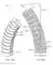 Fig. 16 - Shape adaptable intramedullary fixation device