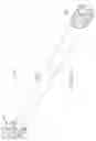 Fig. 26 - Shape adaptable intramedullary fixation device