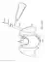 Fig. 37 - Shape adaptable intramedullary fixation device