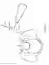 Fig. 41 - Shape adaptable intramedullary fixation device