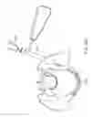 Fig. 44 - Shape adaptable intramedullary fixation device