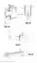 Fig. 06 - Method and system for providing a suture wrap cerclage