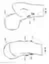 Fig. 25 - Fixation systems and methods