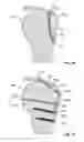 Fig. 30 - Fixation systems and methods