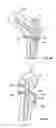 Fig. 32 - Fixation systems and methods