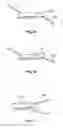 Fig. 36 - Fixation systems and methods