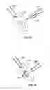 Fig. 41 - Fixation systems and methods