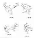 Fig. 42 - Fixation systems and methods
