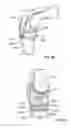 Fig. 43 - Fixation systems and methods