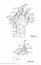 Fig. 57 - Fixation systems and methods