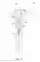 Fig. 06 - Instruments and method for use in disassembling implants