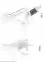 Fig. 09 - Methods and devices to treat nasal airways