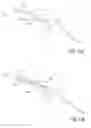 Fig. 15 - Methods and devices to treat nasal airways