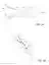 Fig. 16 - Methods and devices to treat nasal airways